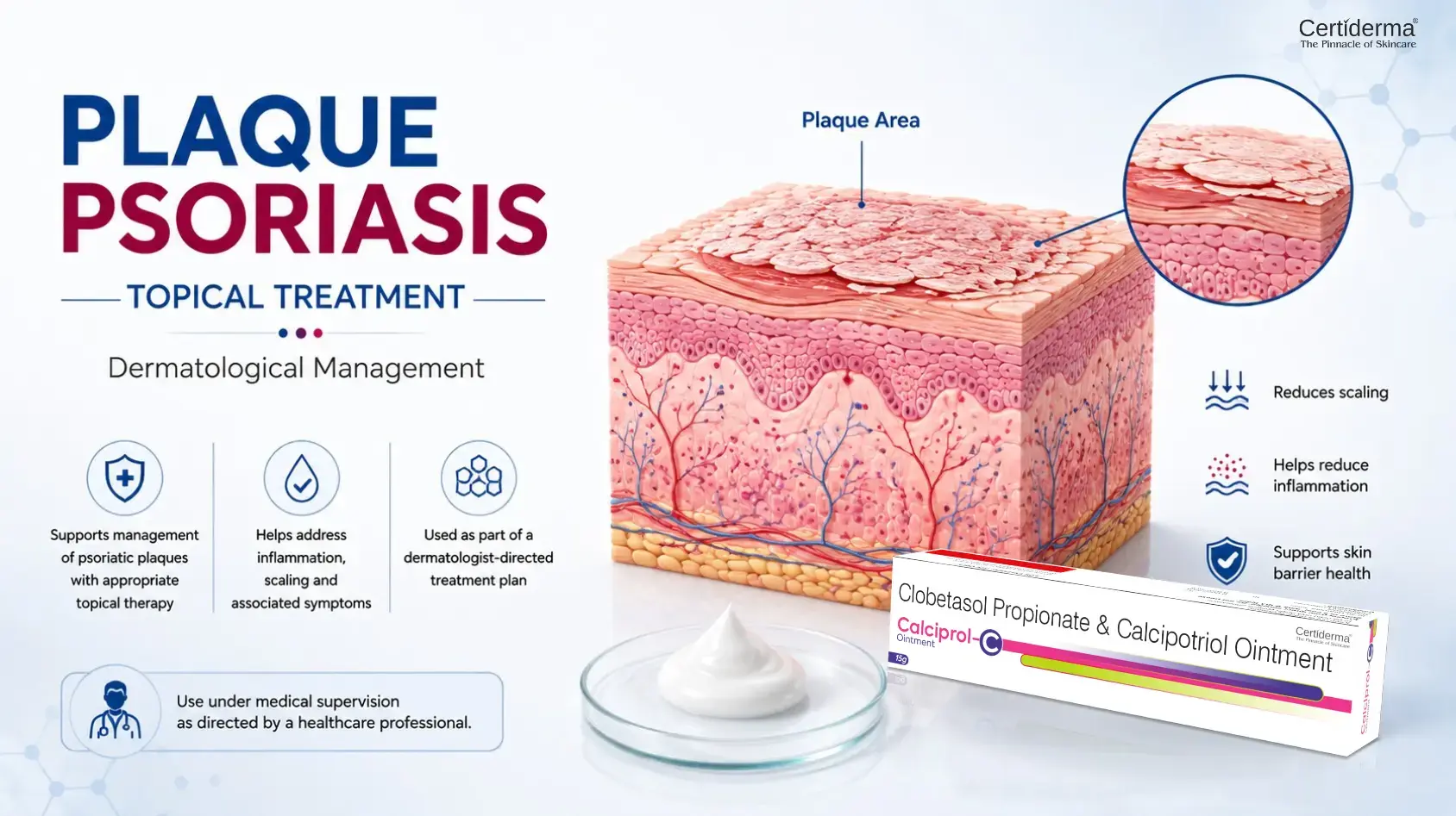 Clobetasol Calcipotriol topical treatment concept for plaque psoriasis showing dermatological management of inflammation scaling and related skin changes with Certiderma