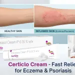 Certiclo Cream for Eczema & Psoriasis: Fast Relief with Clobetasol Propionate 0.05%