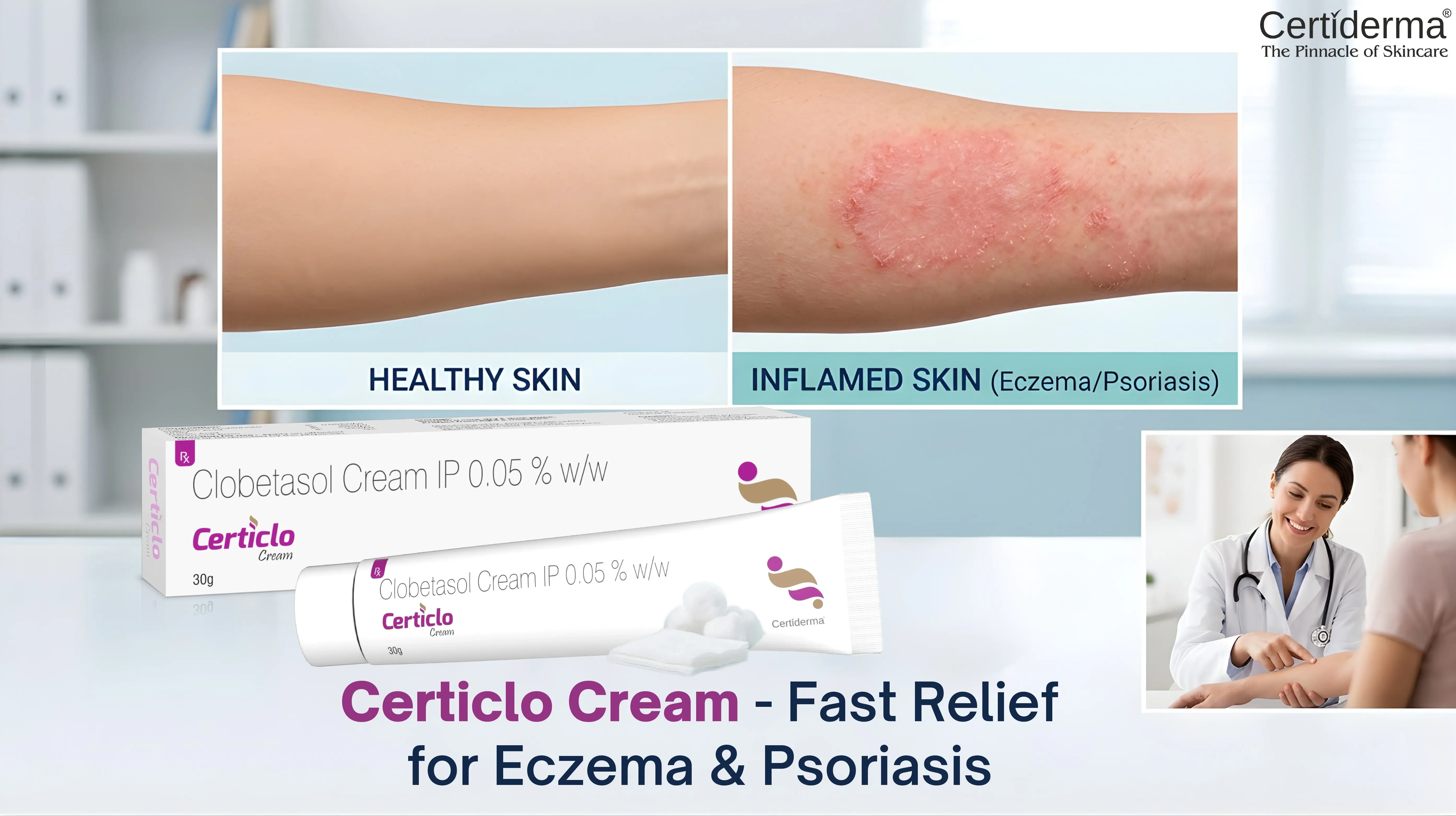 Certiderma Certiclo Cream for eczema and psoriasis relief with Clobetasol Propionate reducing inflamed skin Guide