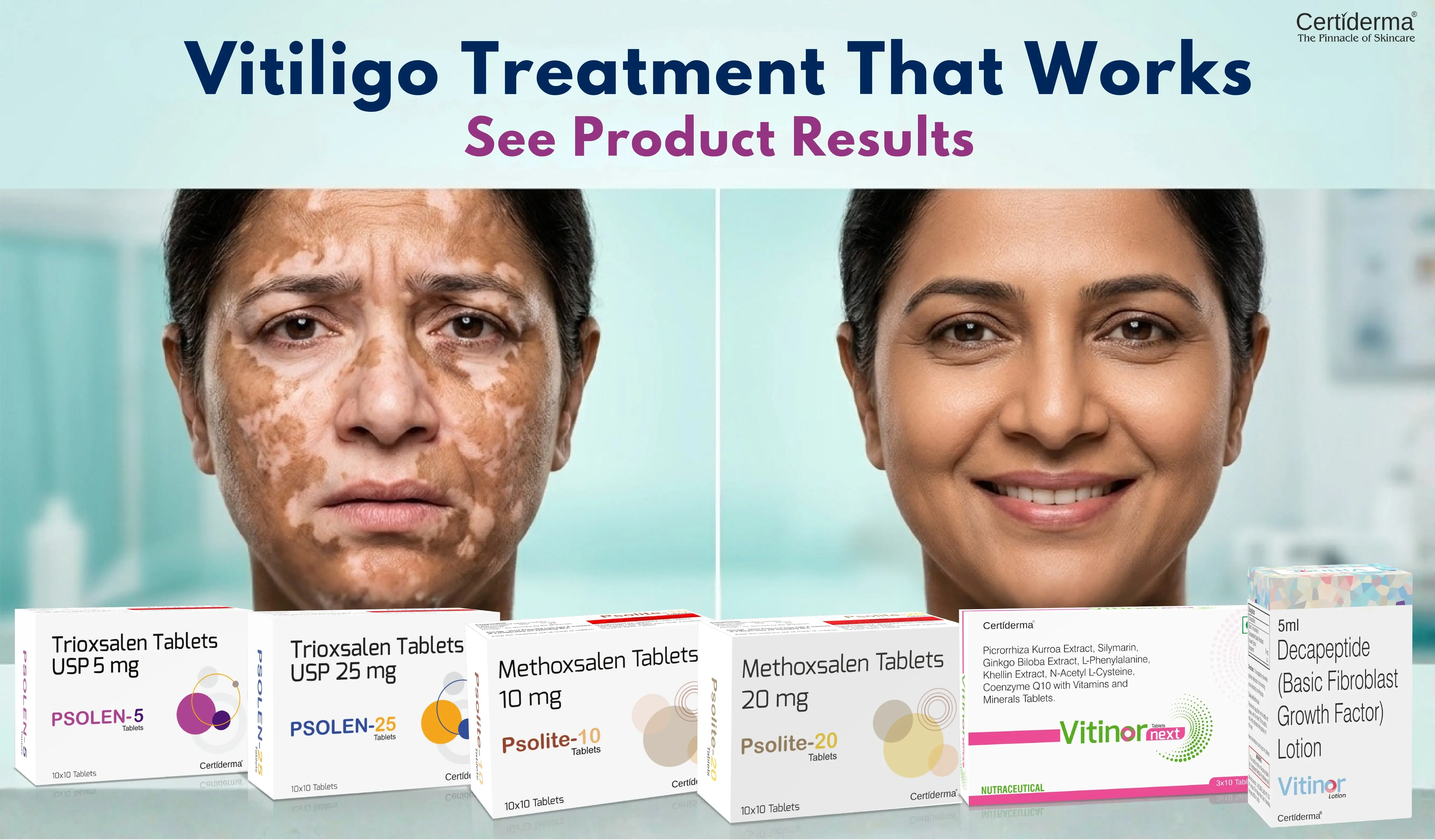 certiderma-vitiligo-treatment-before-after-results-repigmentation-success
