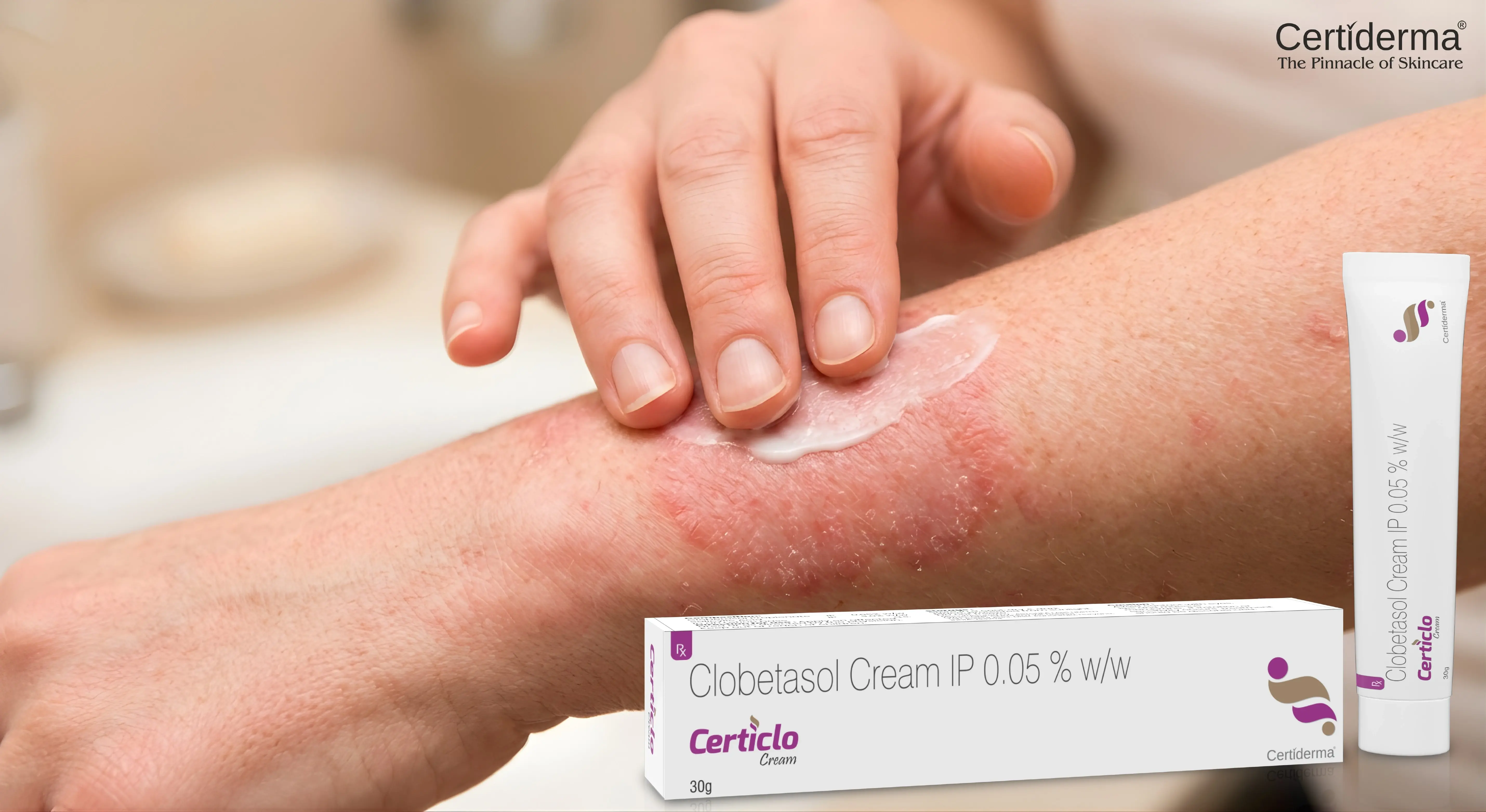 Applying Certiclo Clobetasol Propionate Cream on inflamed eczema skin for itching and redness relief image by Certiderma